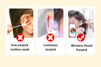 Wireless Visual Ear Wax Removal